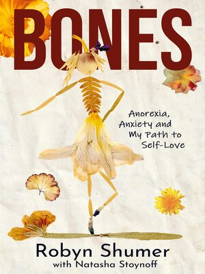 cover image of Bones